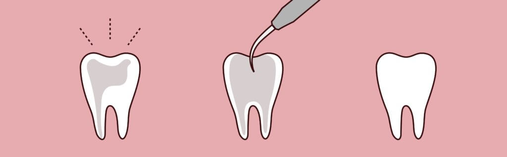 Horizons Dental Care | Dentist in Ottawa -