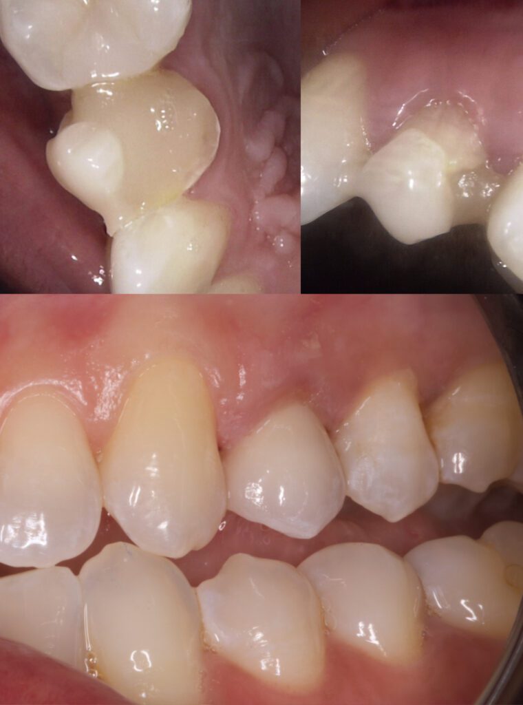 Horizons Dental Care | Dentist in Ottawa -